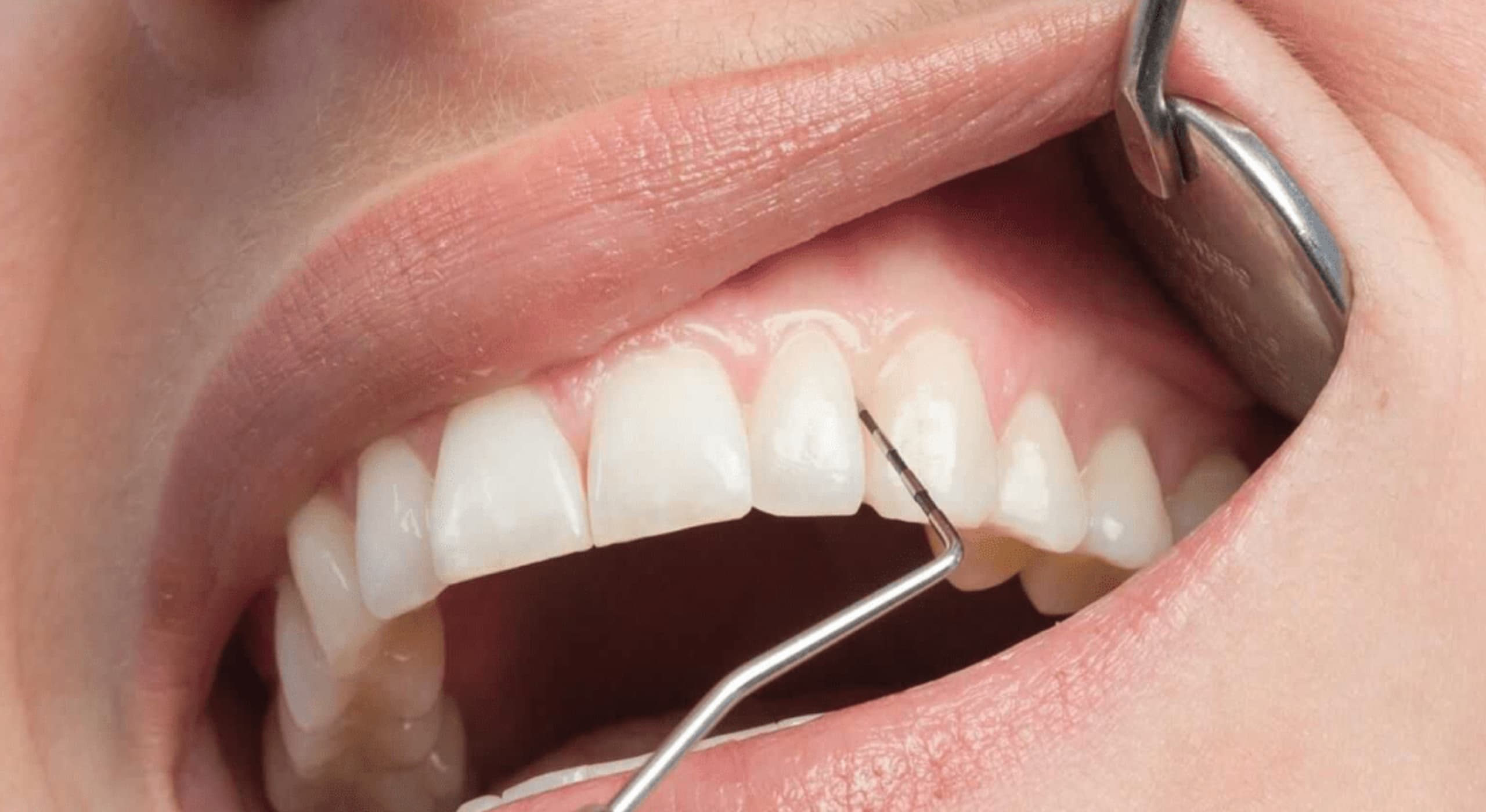 Consultation de contrôle